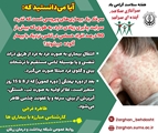  هر آنچه که باید در مورد سرخک بدانید!